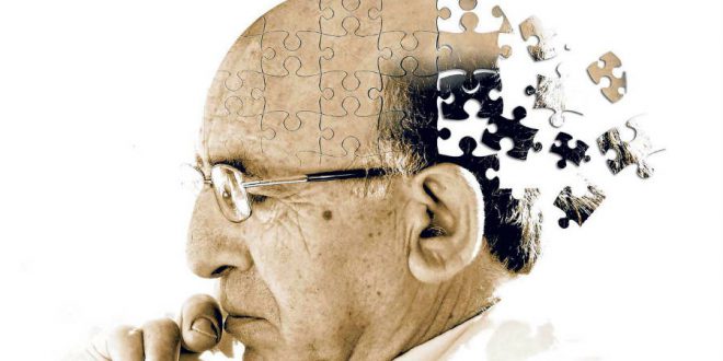 Alzheimer-disease-patients
